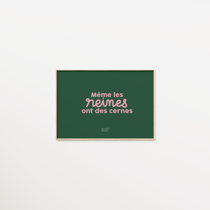 Même les reines ont des cernes